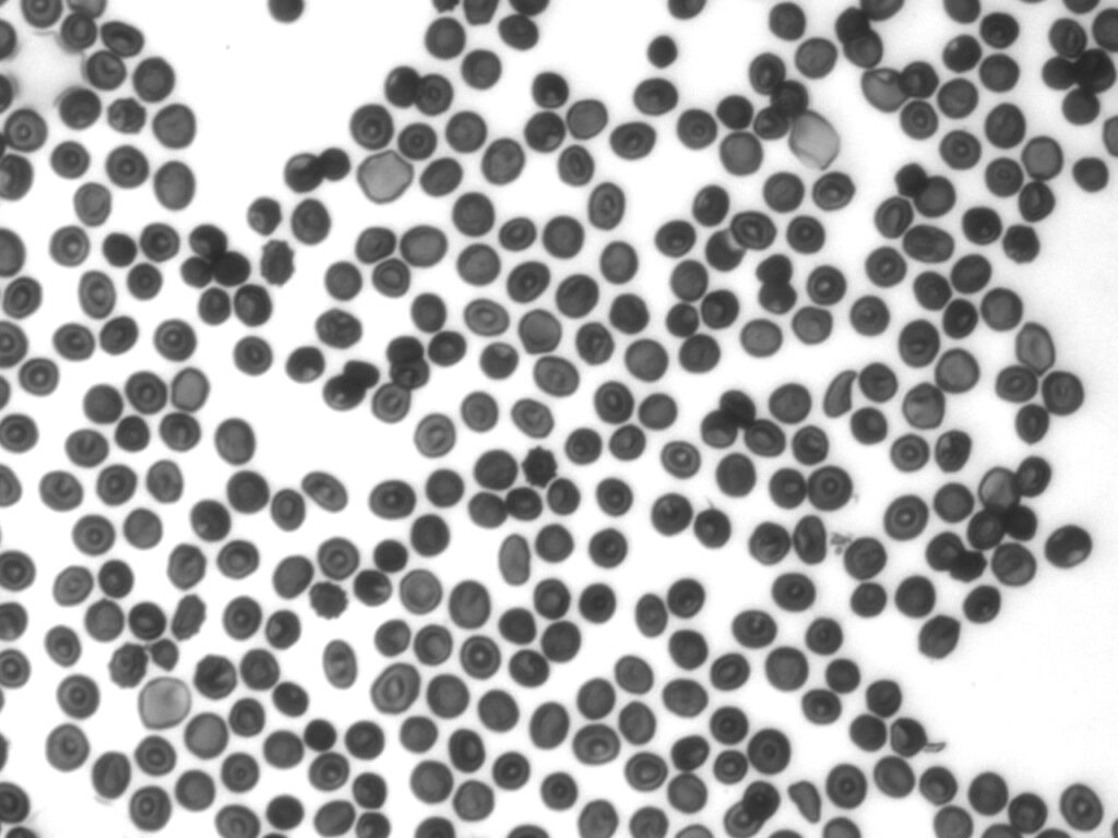 UV microscope image